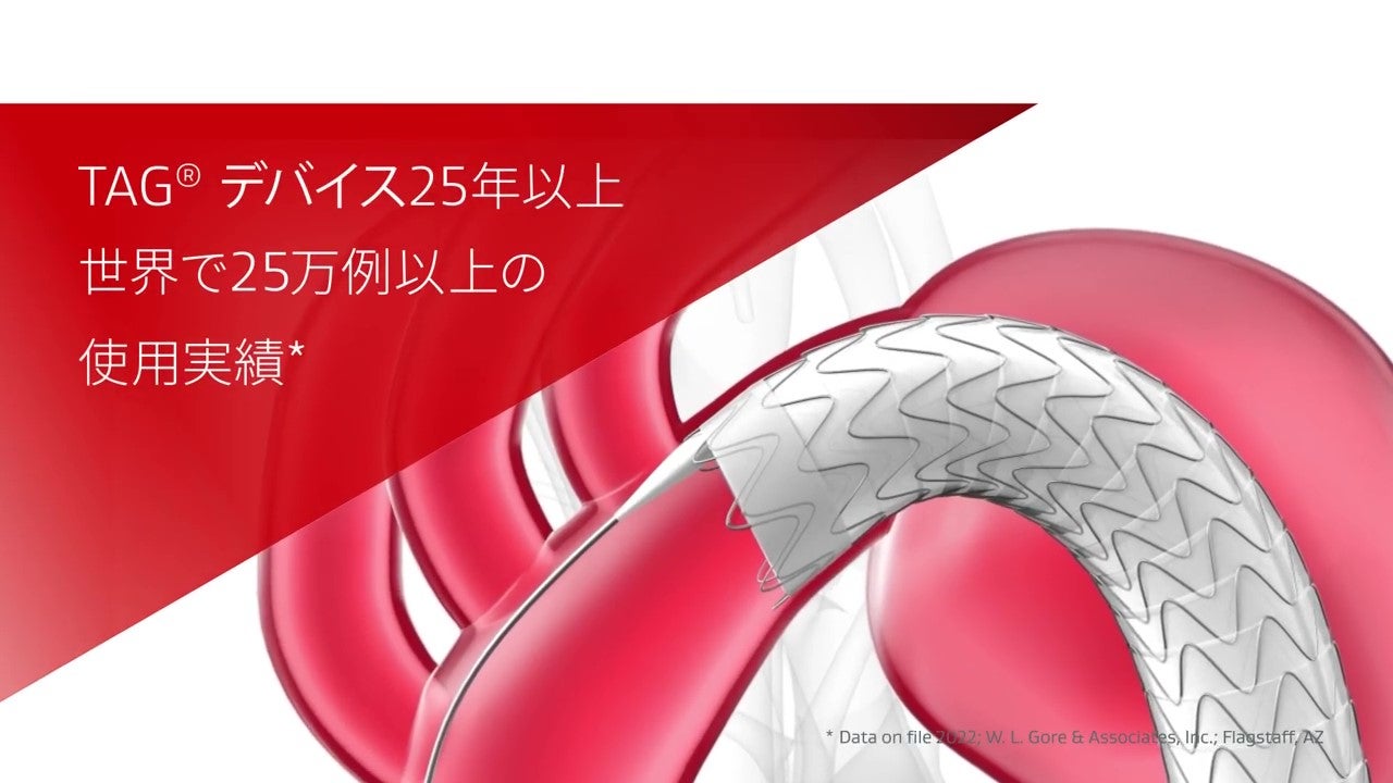TEVARのパイオニアとして世界で25年 日本で15年 | 日本ゴア
